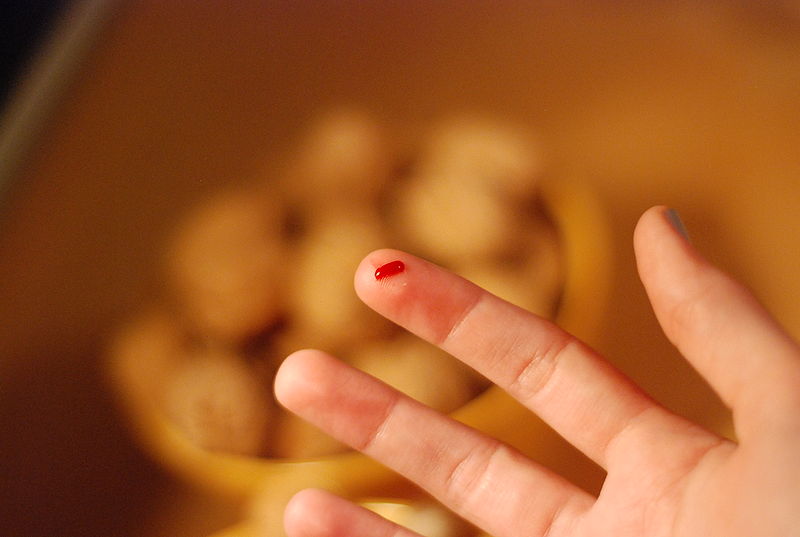 चित्र:Blood-On-Finger.jpg